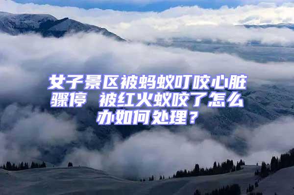 女子景區(qū)被螞蟻叮咬心臟驟停 被紅火蟻咬了怎么辦如何處理?
